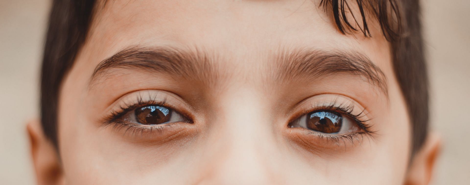 Causes of colour blindness due to disorders (image sourced via Pexels / Photo by mustafa)